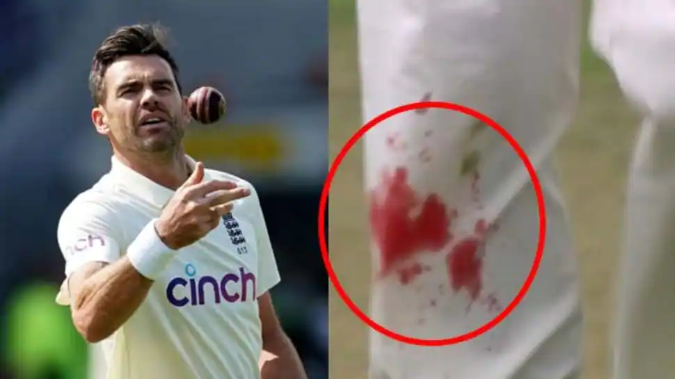 India vs England 4th Test: James Anderson bowls with bleeding knee, video goes viral